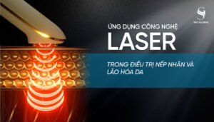Laser trị nếp nhăn