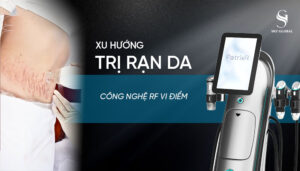 Điều trị rạn da sau sinh bằng công nghệ laser hiện đại