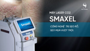 Máy laser CO2 Smaxel trị sẹo rỗ hiệu quả