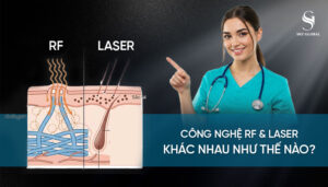 Công nghệ RF khác laser như thế nào?
