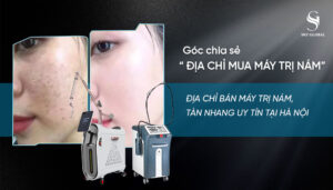 Cửa hàng máy trị nám tàn nhang uy tín tại Hà Nội