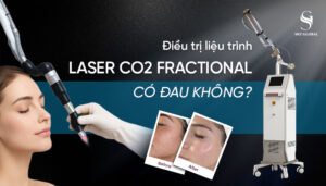 ận cảnh đầu điều trị máy Laser CO2 Fractional hiện đại từ Sky Global tác động vi điểm lên bề mặt da.