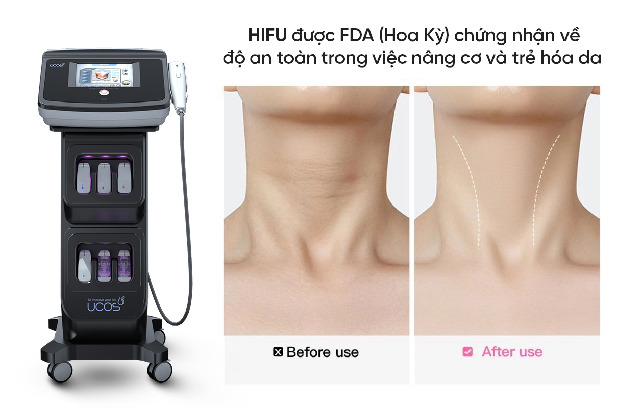 Công nghệ nâng cơ HIFU đạt chứng nhận an toàn y khoa từ FDA Hoa Kỳ
