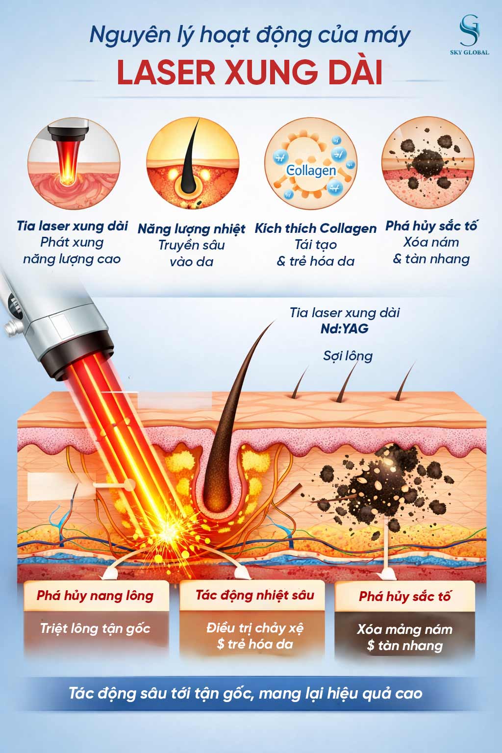 Nguyên lý hoạt động của laser xung dài Nd:YAG tác động sâu vào nang lông và sắc tố da