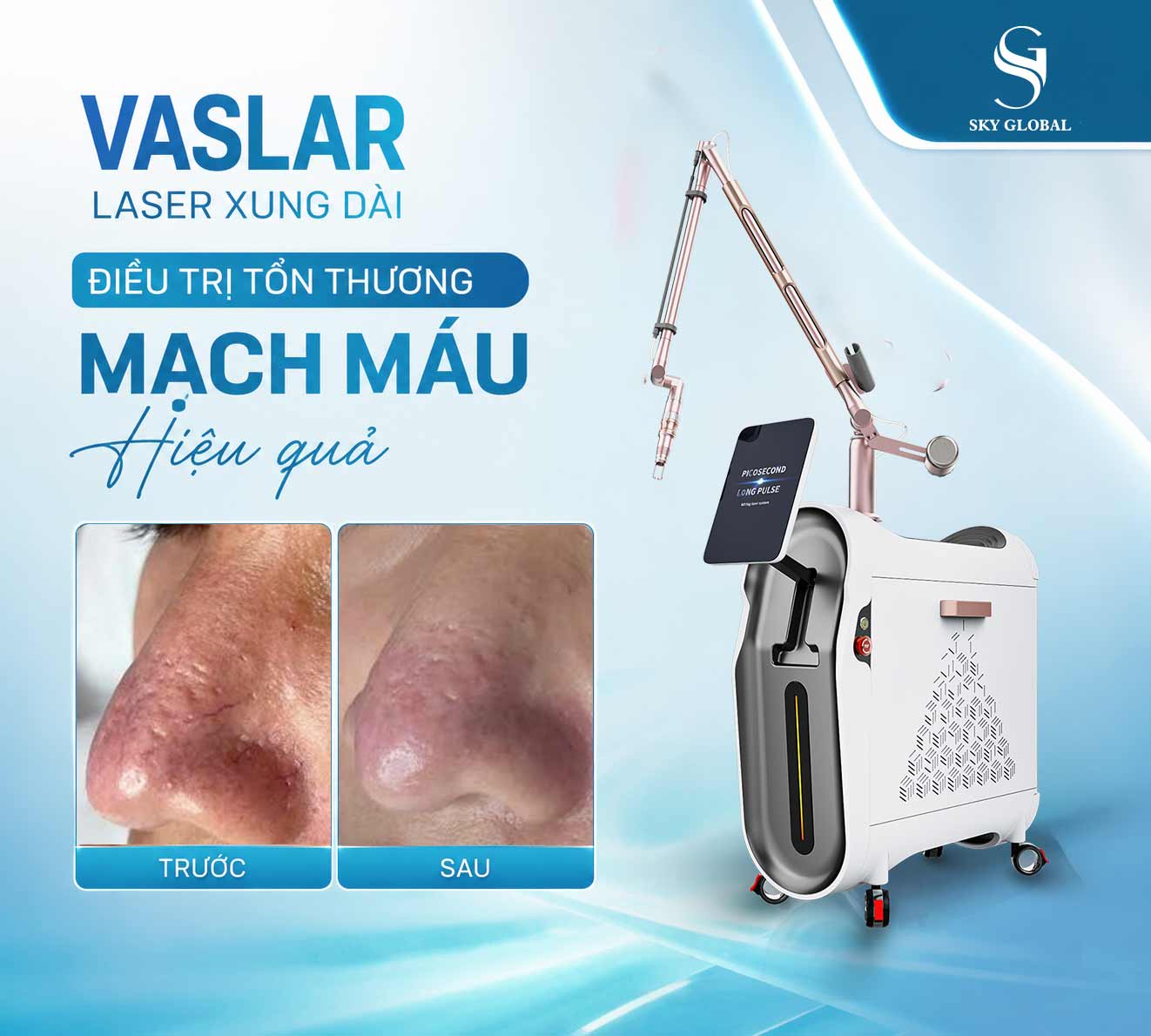 Máy laser xung dài Vaslar hỗ trợ điều trị tổn thương mạch máu