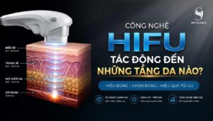 Công nghệ HIFU tác động đến những tầng da nào